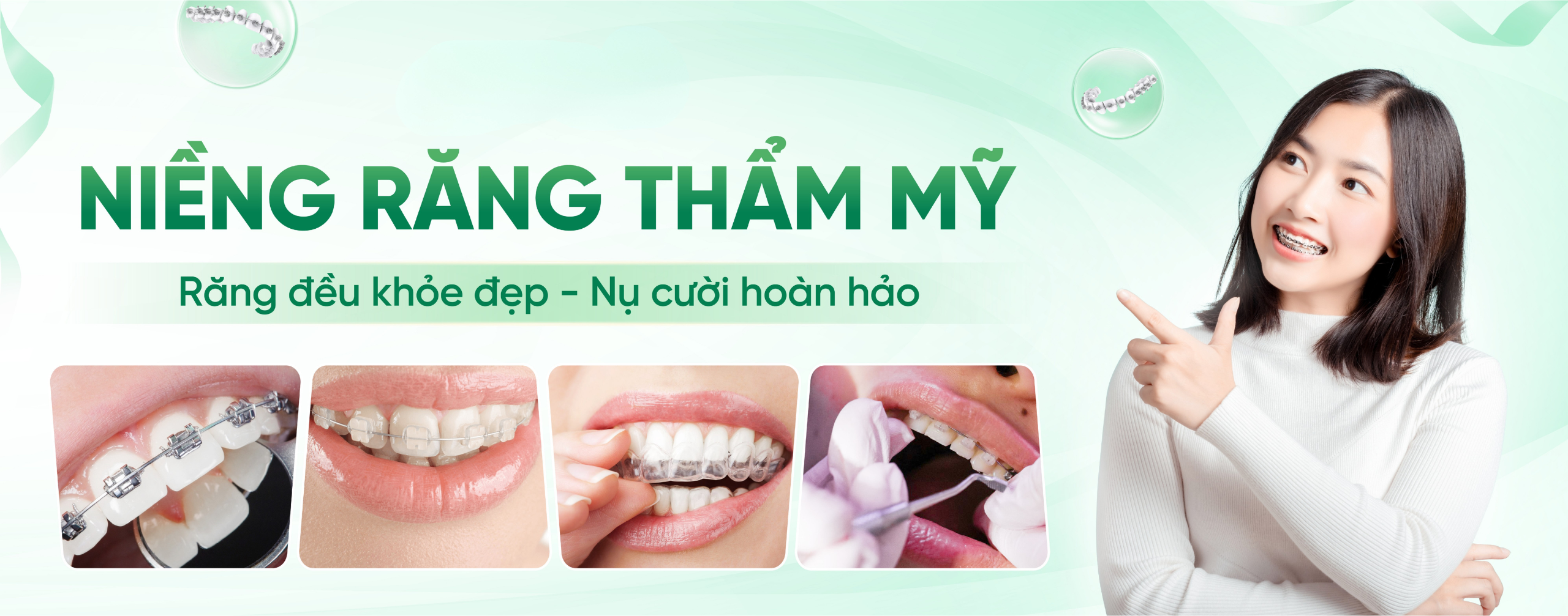 Niềng răng thẩm mỹ