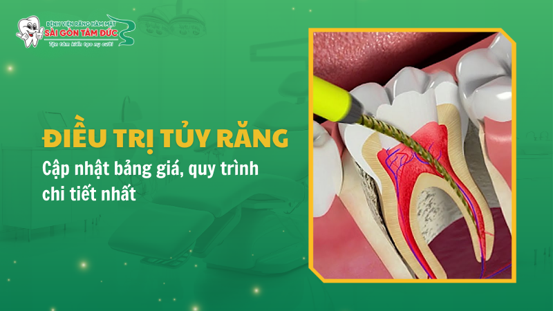 1thumb dieu tri tuy rang benhvienranghammatsaigontamduc