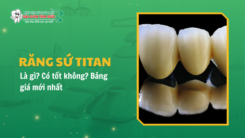 Răng sứ Titan là gì? Có tốt không? Bảng giá mới nhất 2026