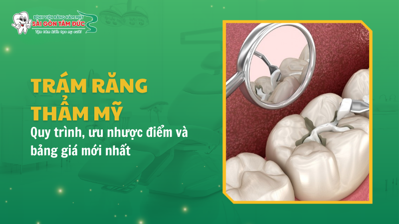 Trám răng thẩm mỹ là gì? Quy trình, ưu nhược điểm và bảng giá mới nhất 2026