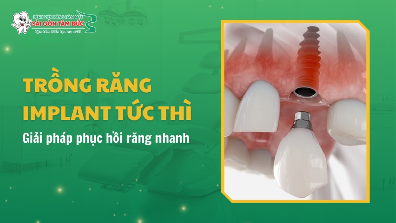 1thumb trong rang implant tuc thi benhvienranghammatsaigontamduc