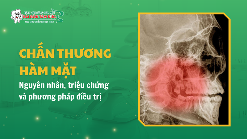 Chấn thương hàm mặt: Nguyên nhân, triệu chứng và phương pháp điều trị hiệu quả