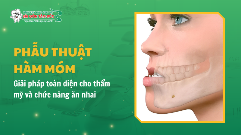 Phẫu thuật hàm móm: Giải pháp toàn diện cho thẩm mỹ và chức năng ăn nhai