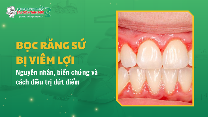 boc rang su bi viem loi 1