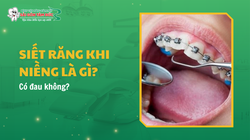 siet rang khi nieng 1