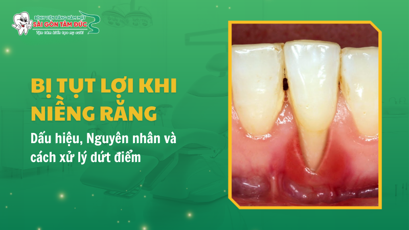 tut loi khi nieng rang 1